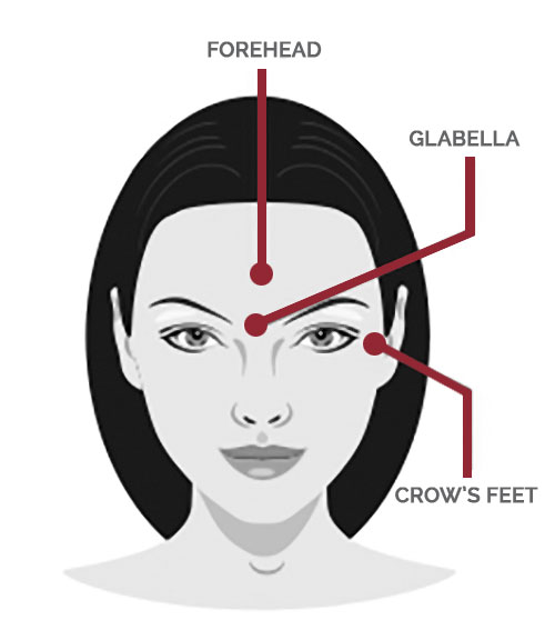 Nurture Beauty Botox Areas